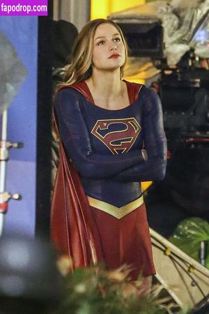 Melissa Benoist Melissabenoist Leaks From OnlyFans Page 2