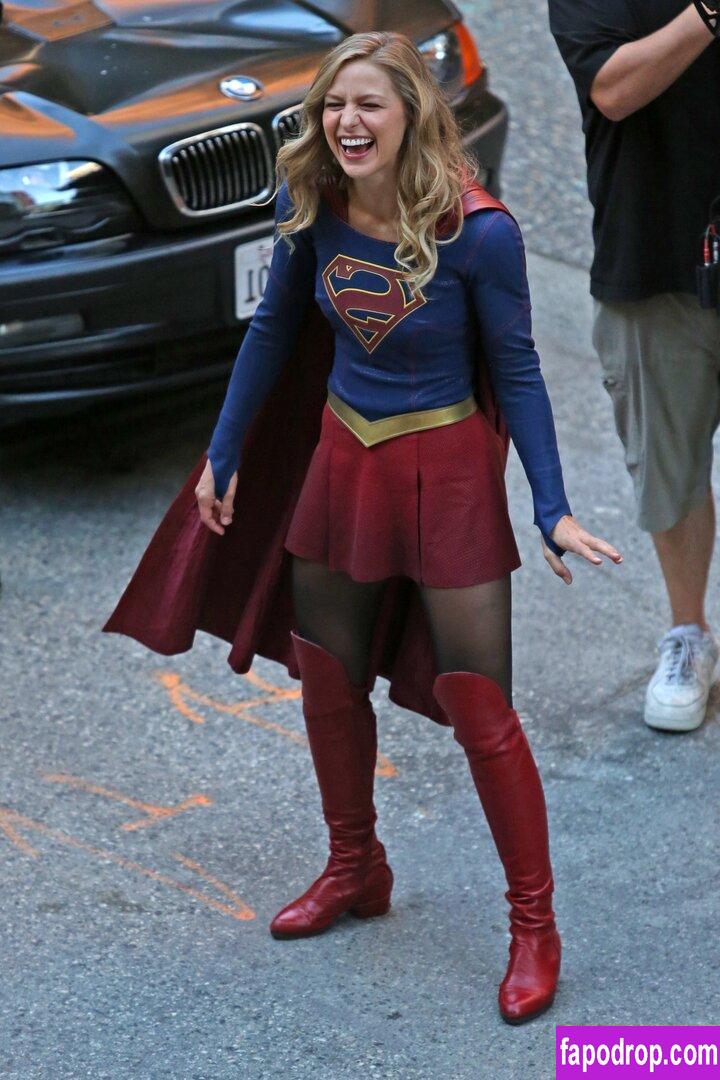 Melissa Benoist Melissabenoist Leaked Nude Photo From OnlyFans And Patreon