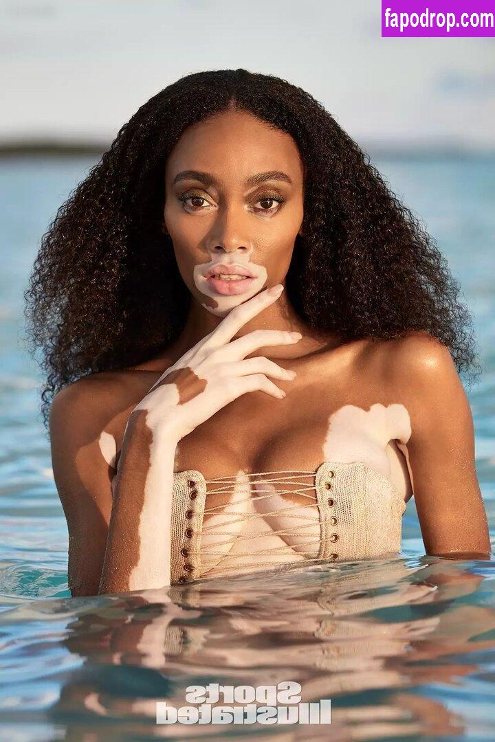 Winnie Harlow / winnieharlow слитое обнаженное фото #0091 с Онлифанс или Патреон