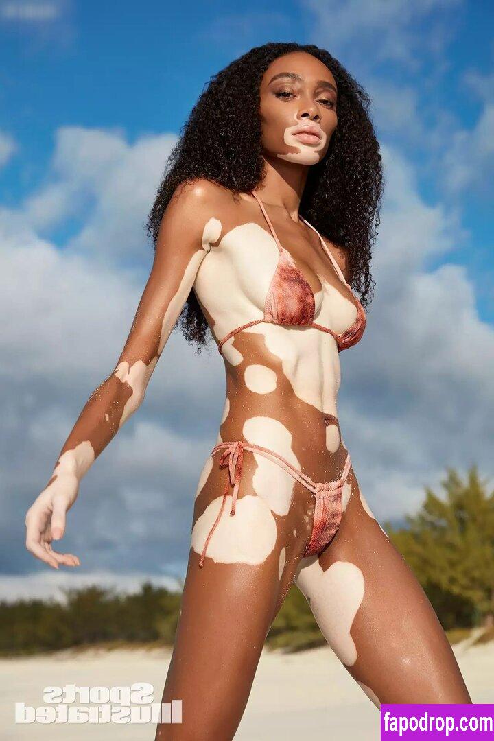 Winnie Harlow / winnieharlow слитое обнаженное фото #0093 с Онлифанс или Патреон