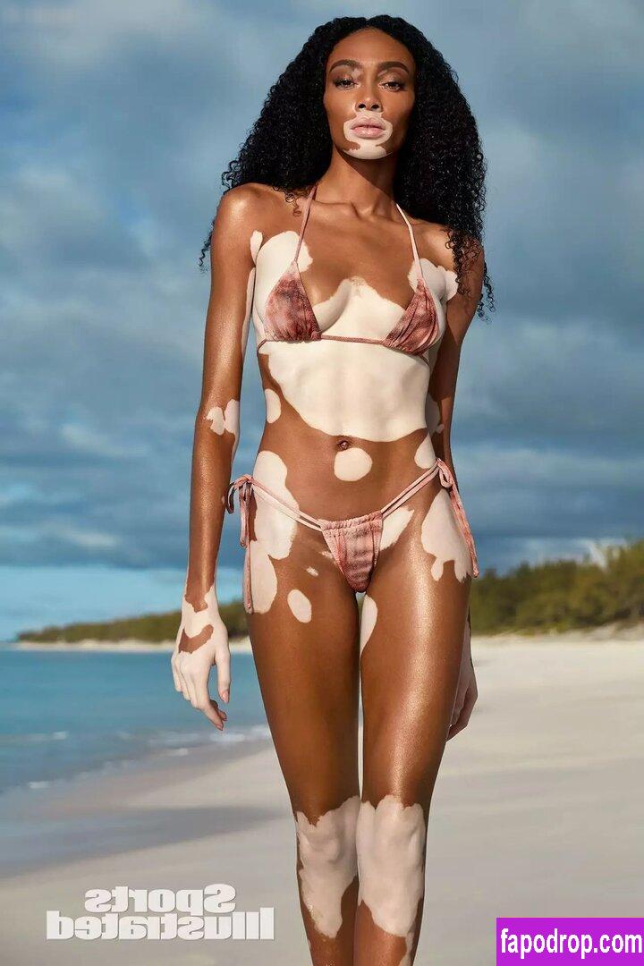 Winnie Harlow / winnieharlow слитое обнаженное фото #0094 с Онлифанс или Патреон