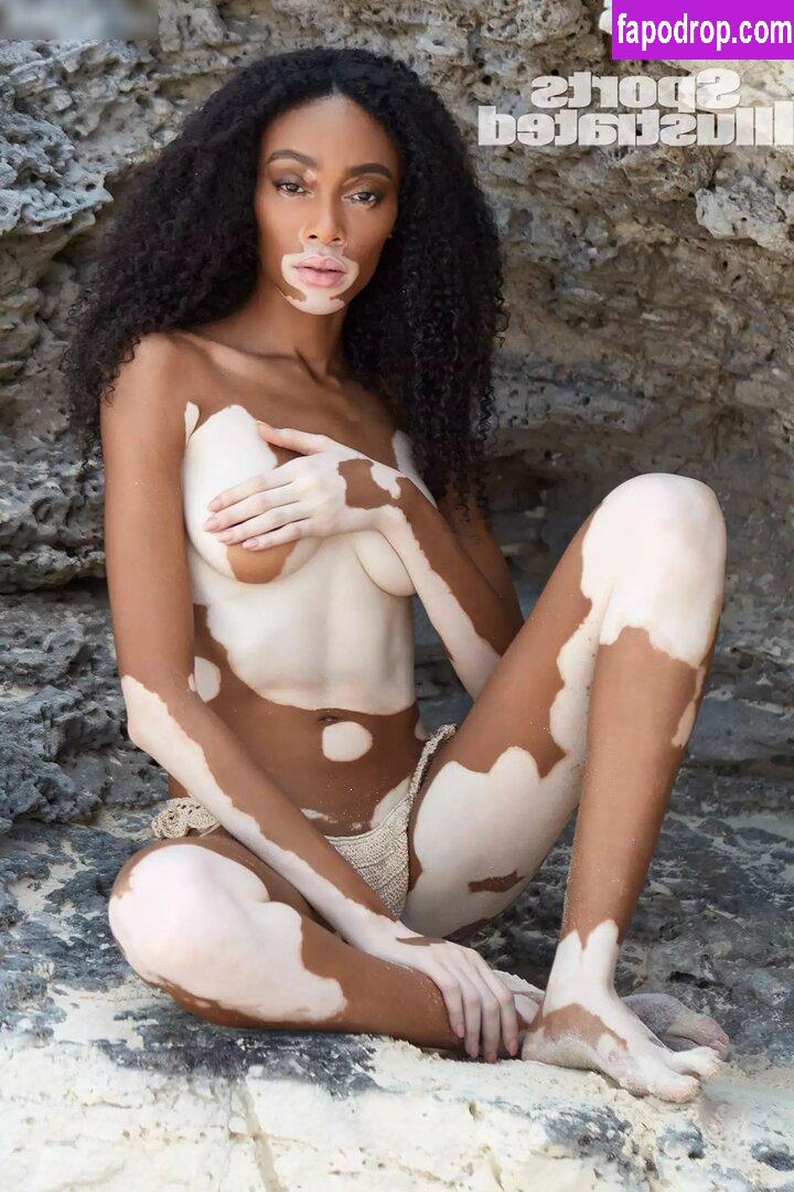 Winnie Harlow / winnieharlow слитое обнаженное фото #0097 с Онлифанс или Патреон