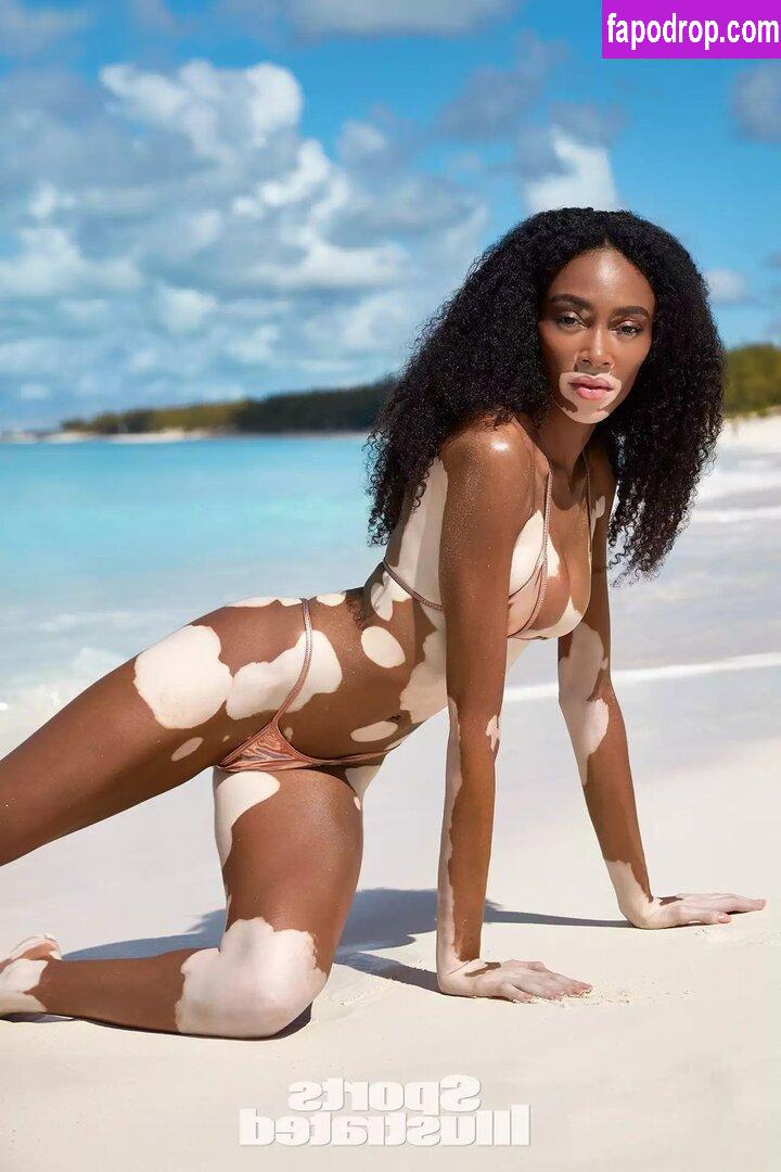 Winnie Harlow / winnieharlow слитое обнаженное фото #0100 с Онлифанс или Патреон