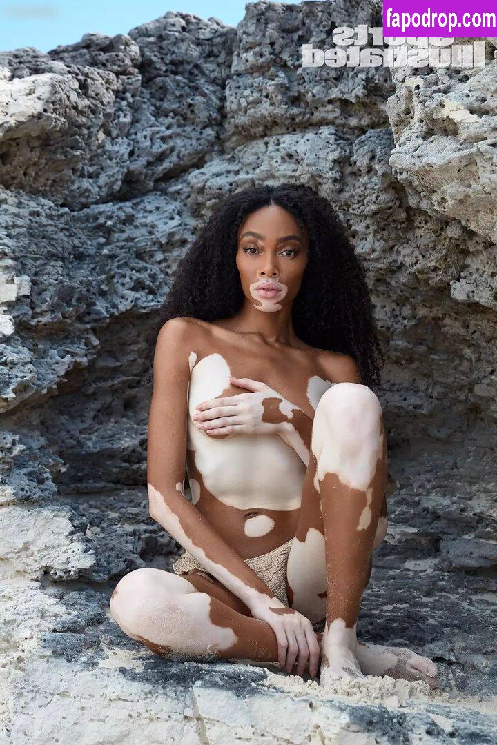 Winnie Harlow / winnieharlow leak of nude photo #0108 from OnlyFans or Patreon