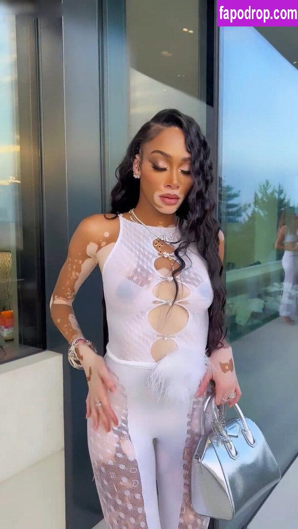 Winnie Harlow / winnieharlow leak of nude photo #0114 from OnlyFans or Patreon