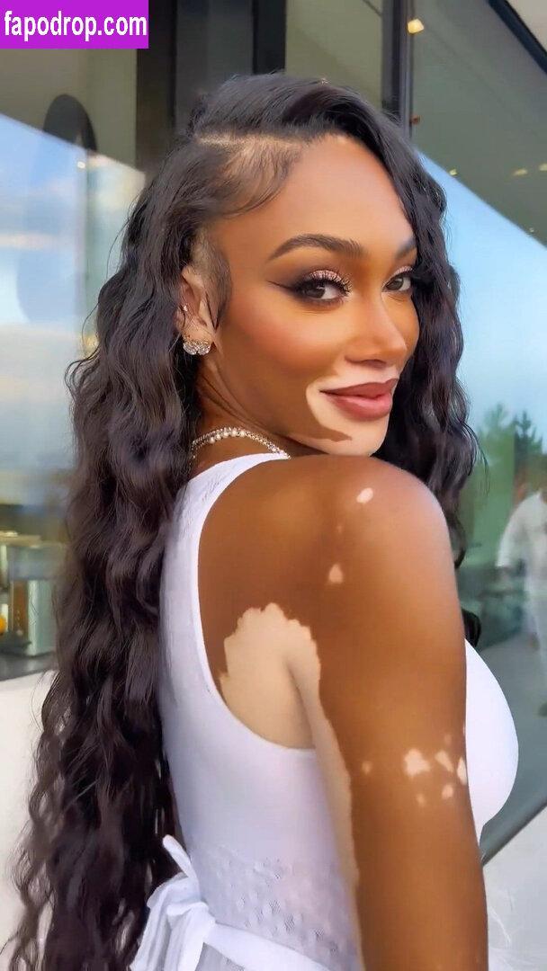 Winnie Harlow / winnieharlow leak of nude photo #0118 from OnlyFans or Patreon